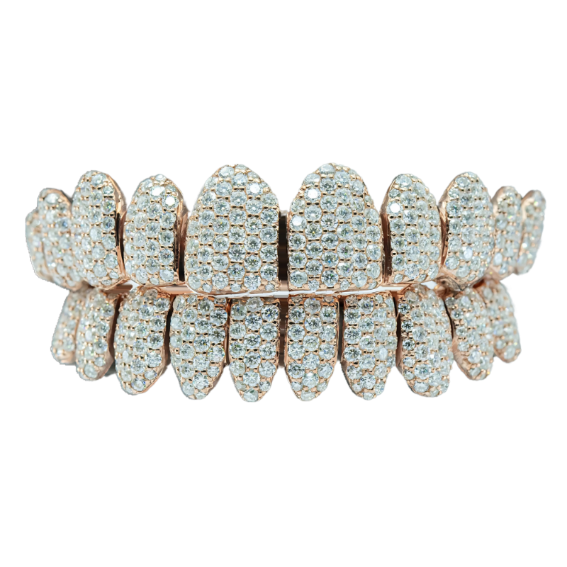 Moissanite Diamond Grillz – Sparkle Beyond Compare
