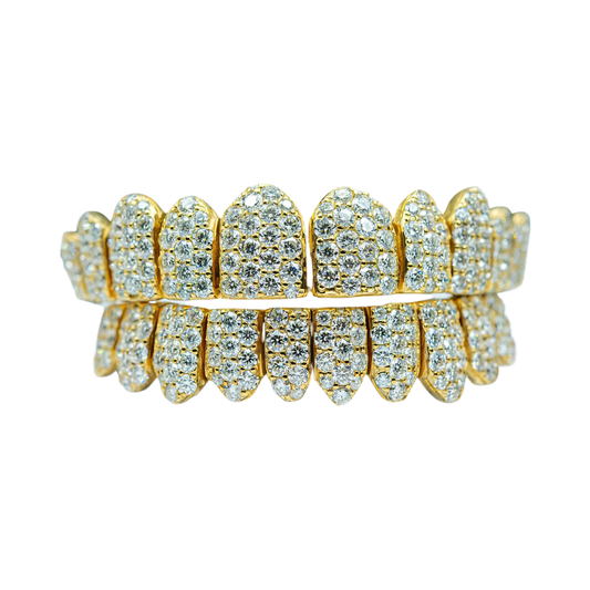 Jumbo (6 Pointer) VVS Moissanite Diamond Grillz – Bold Shine, Ultimate Luxury