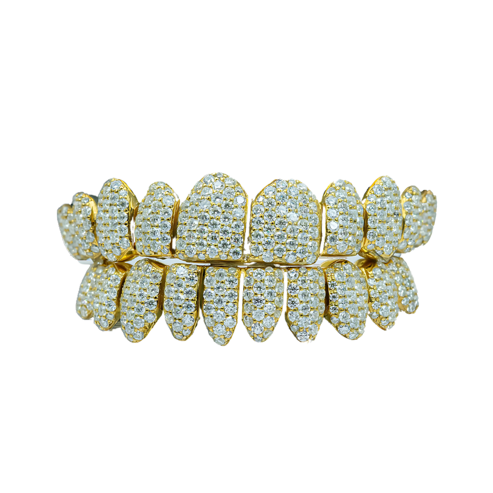Moissanite Diamond Grillz – Sparkle Beyond Compare