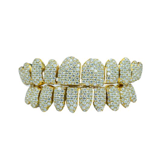 Moissanite Diamond Grillz – Sparkle Beyond Compare