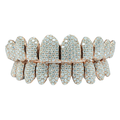 Moissanite Diamond Grillz – Sparkle Beyond Compare