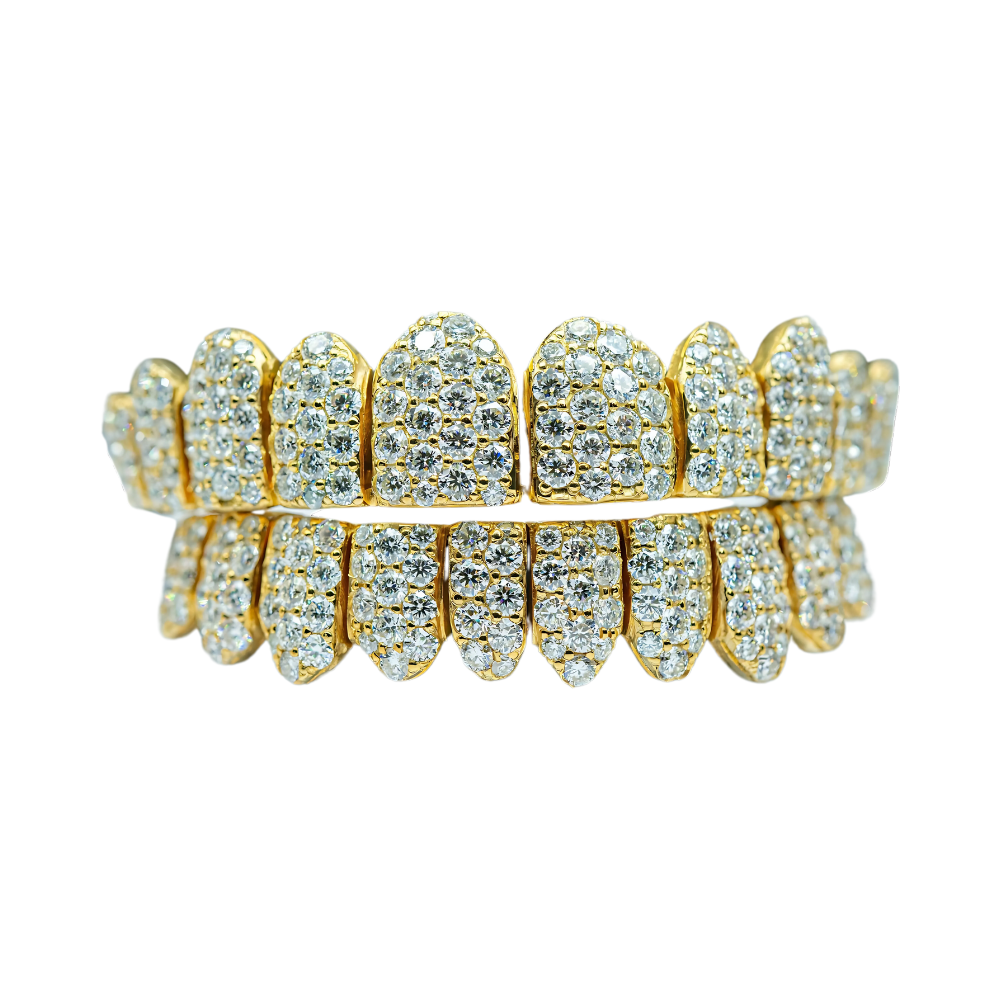 Jumbo (6 Pointer) VVS Moissanite Diamond Grillz – Bold Shine, Ultimate Luxury