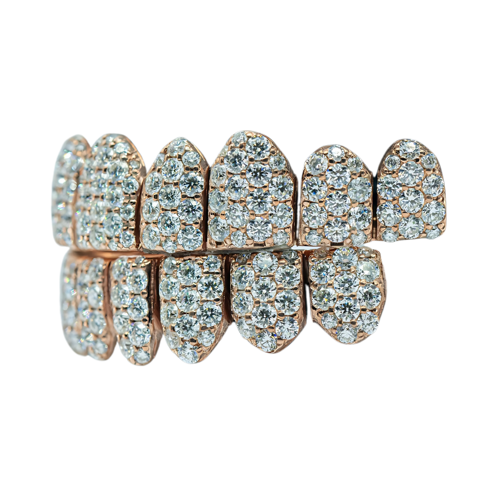 Jumbo (6 Pointer) VVS Moissanite Diamond Grillz – Bold Shine, Ultimate Luxury