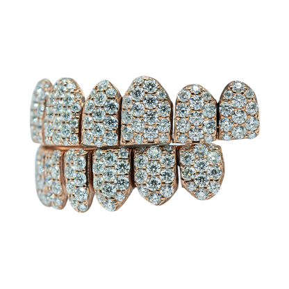 Jumbo (6 Pointer) VVS Moissanite Diamond Grillz – Bold Shine, Ultimate Luxury