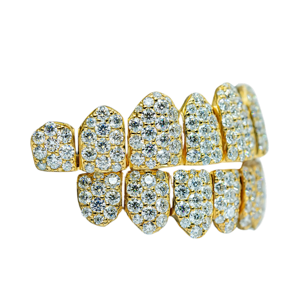 Jumbo (6 Pointer) VVS Moissanite Diamond Grillz – Bold Shine, Ultimate Luxury