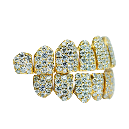 Jumbo (6 Pointer) VVS Moissanite Diamond Grillz – Bold Shine, Ultimate Luxury