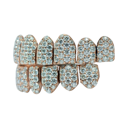 Jumbo (6 Pointer) VVS Moissanite Diamond Grillz – Bold Shine, Ultimate Luxury