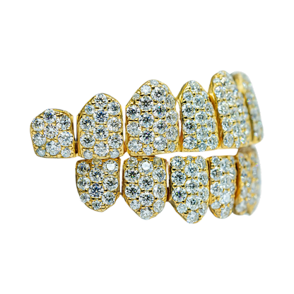 Jumbo (6 Pointer) VVS Moissanite Diamond Grillz – Bold Shine, Ultimate Luxury