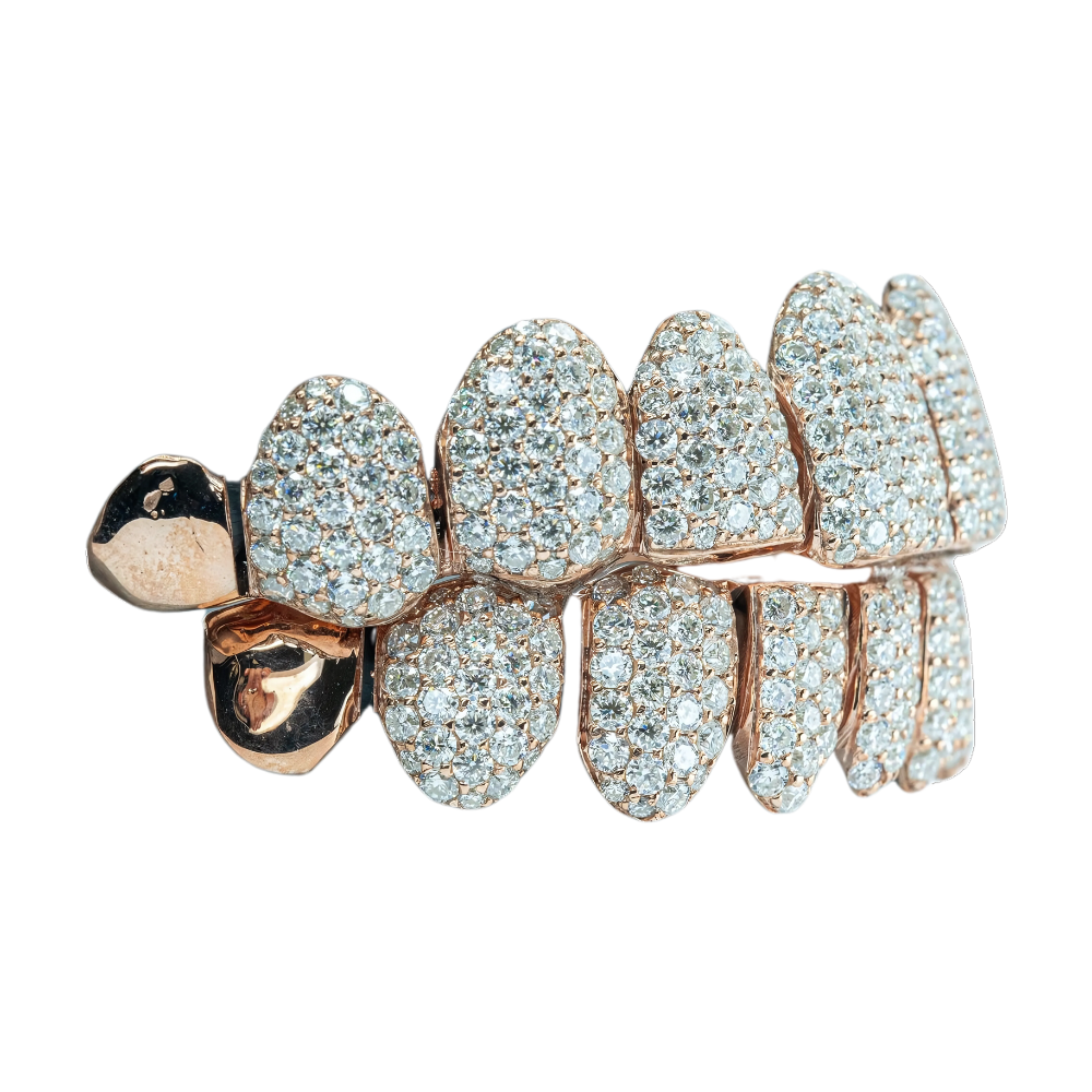 End Cap VVS Moissanite Diamond Grillz – Subtle Sparkle, Bold Statement