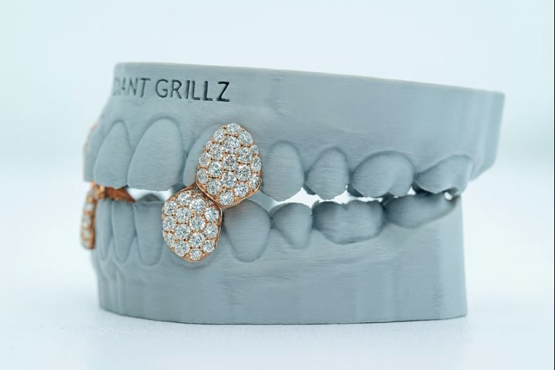 Fang With Back Bar 6 Pointer VVS Moissanite Diamond Grillz