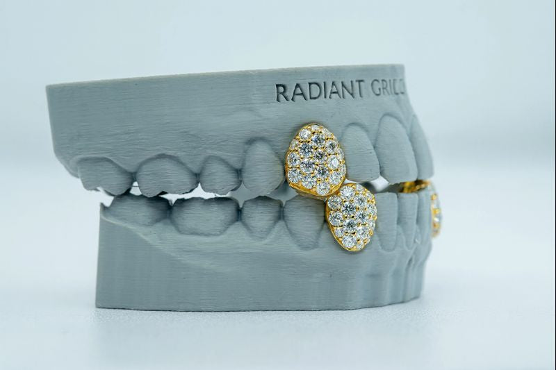 Fang With Back Bar 6 Pointer VVS Moissanite Diamond Grillz