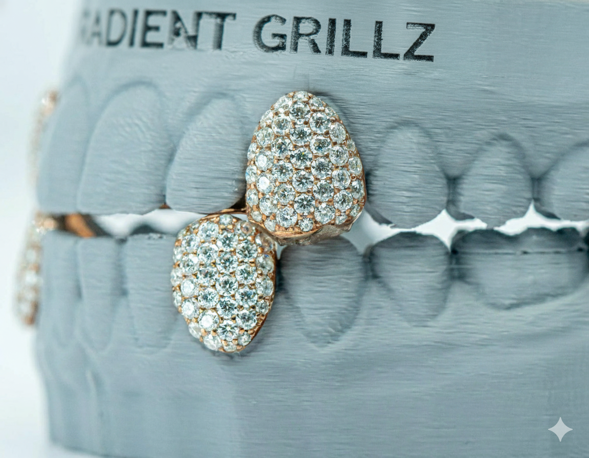 Fang With Back Bar VVS Moissanite Diamond Grillz
