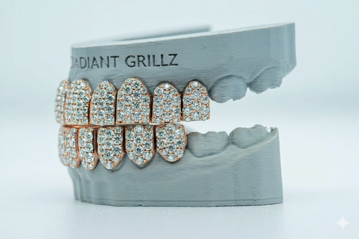 Jumbo (6 Pointer) VVS Moissanite Diamond Grillz